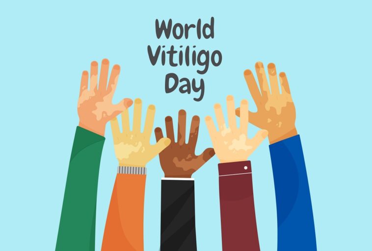 World Vitiligo Day personalized cause